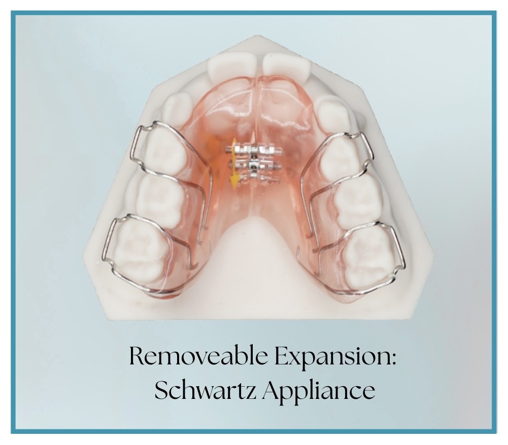 Removeable Schwartz Childrens Airway