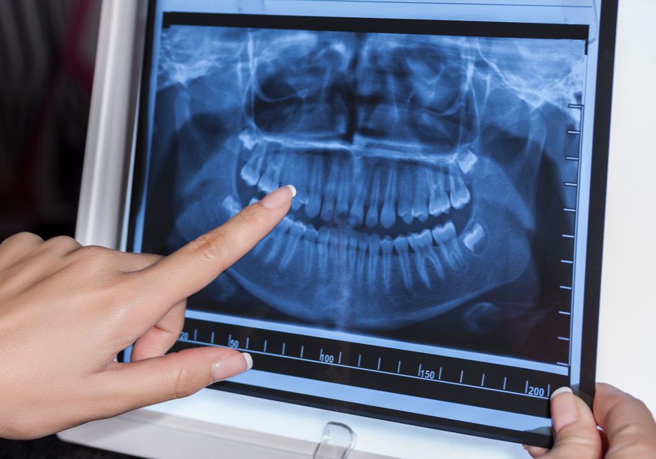 holding-dental-x-ray