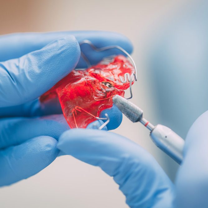 mobile-orthodontic-vivos-appliance mobile-orthodontic-vivos-appliance