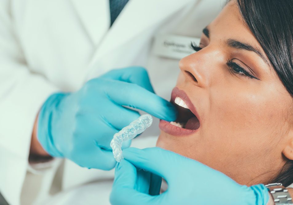tooth-whitening-procedure